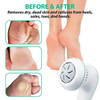 Foot File Electric Skin Safe Callus Remover